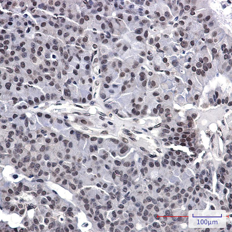 AKAP95 Rabbit mAb